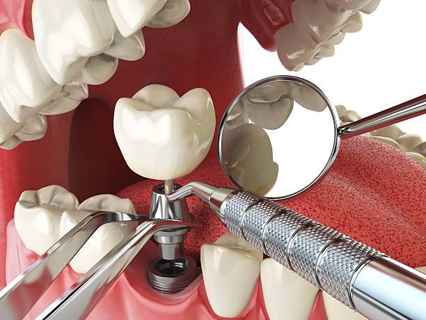 Best Broken Tooth Emergency  in Winnetka, IL